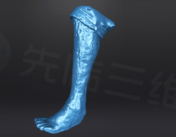 定制康復足托案例